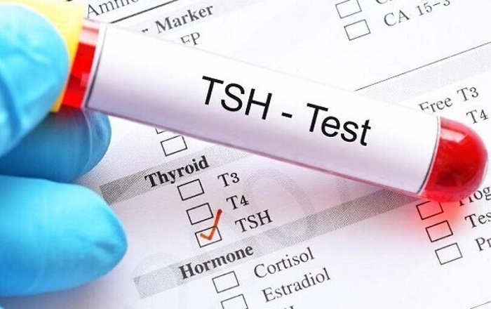 Xét nghiệm Tsh - kiểm tra nồng độ hormone kích thích tuyến giáp