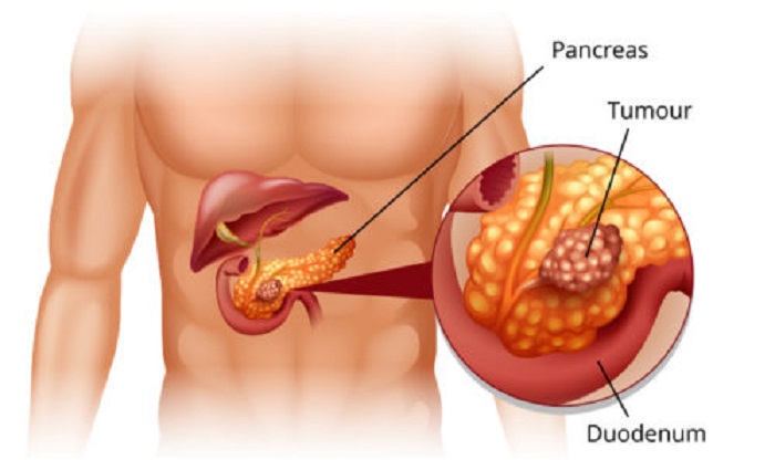 Tuyến tụy nằm ở sau da dạy phía bụng trái của con người